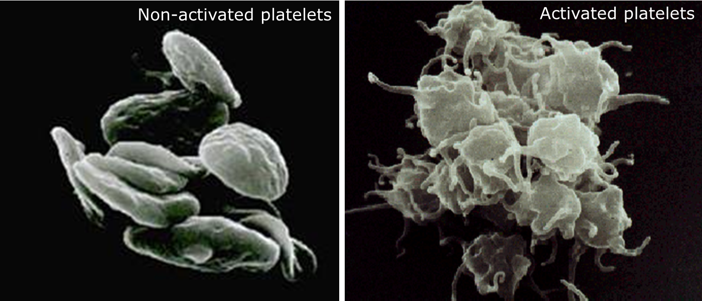 Platelets.png